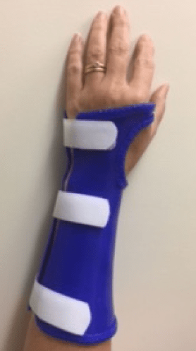 splint for radial head fracture